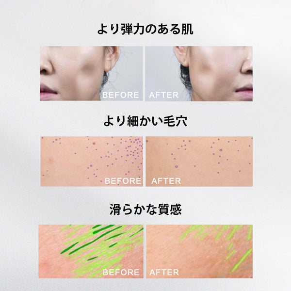 MITOMO 日本製オニノダケ根エキススキンケア 潤い 保湿 フアンペアボトル10mlエキス【EXSA00003-09-010】