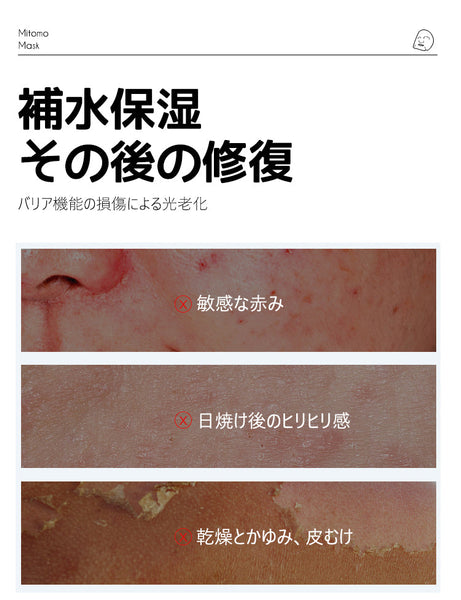 透明感ケア/美友フェイスマスクBR パール&リンゴ配合 35枚入り【MTSA00505-E-2】