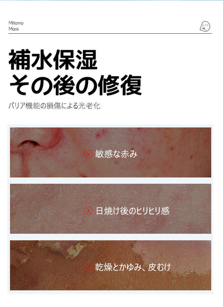 毛穴&透明感ケア/美友フェイスマスクPO 竹炭×レチノール配合 35枚【MTSA00505-E-3】