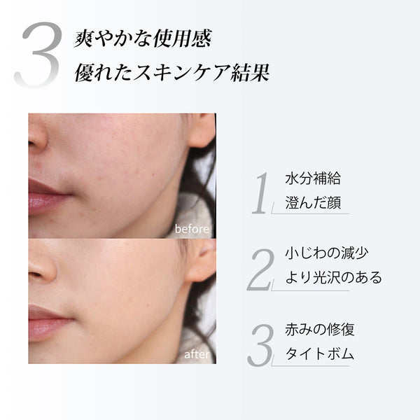 MITOMO 日本製ダイズ胎座エキススキンケア 潤い 保湿 フアンペアボトル10mlエキス【EXSA00006-03-010】